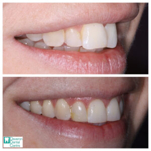 3 DD DD - Smile - Right