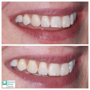 7 KD KD - Smile - Right